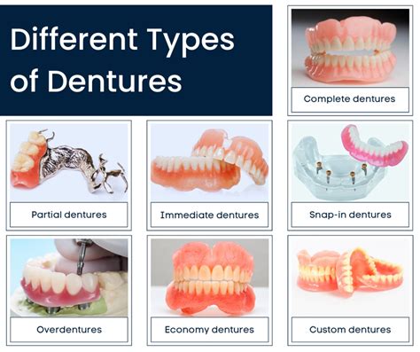 what kind of dentures are available with affordable